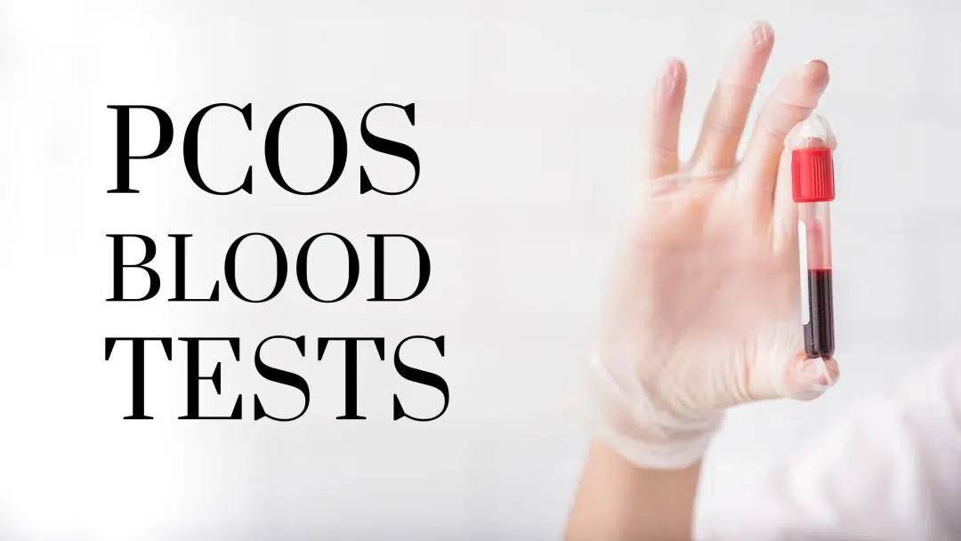 PCOS Blood test vile in labs hands
