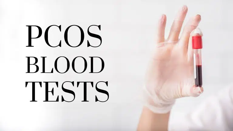 PCOS Blood test vile in labs hands